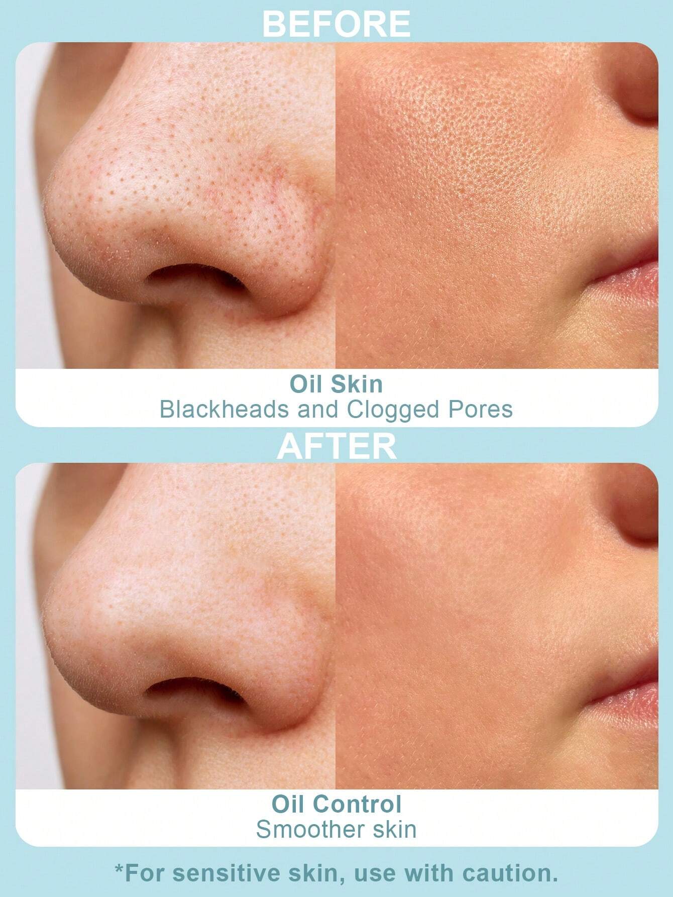 SlowSunday Deep cleansing , Moisturizing Charcoal Bubbling Mask SHEGLAM